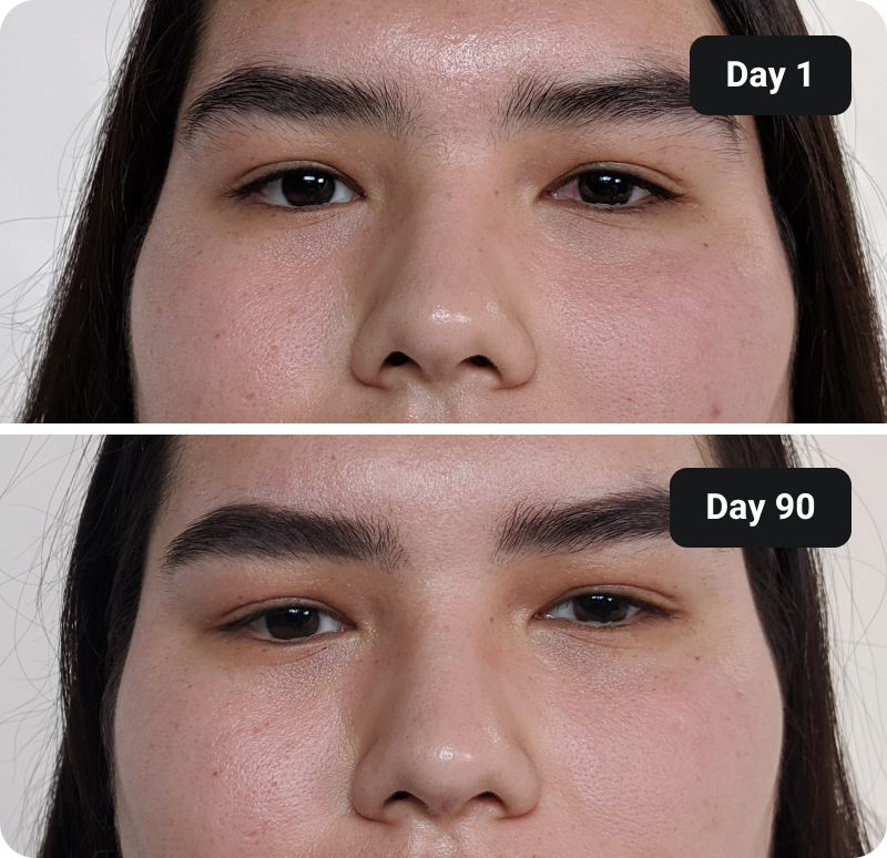 Collagen before and after results